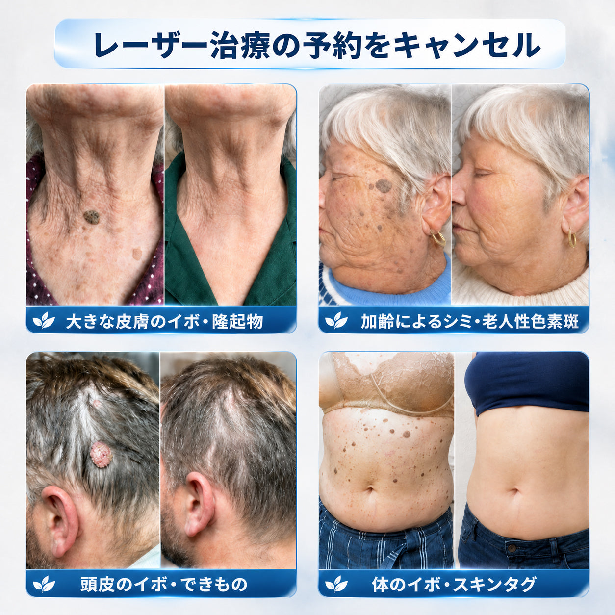 🌿𝐇𝐢𝐒𝐤𝐢𝐧® 🎁 残り2箱のみ！Hiskin® 🎁 ではさらに50%割引！あなたの活力と健康を取り戻すお手伝いをします。