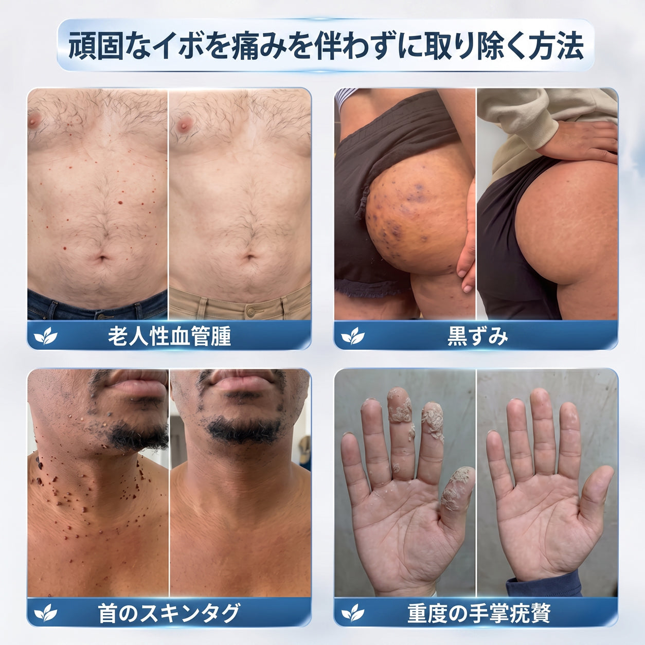 🌿𝐇𝐢𝐒𝐤𝐢𝐧® 🎁 残り2箱のみ！Hiskin® 🎁 ではさらに50%割引！あなたの活力と健康を取り戻すお手伝いをします。