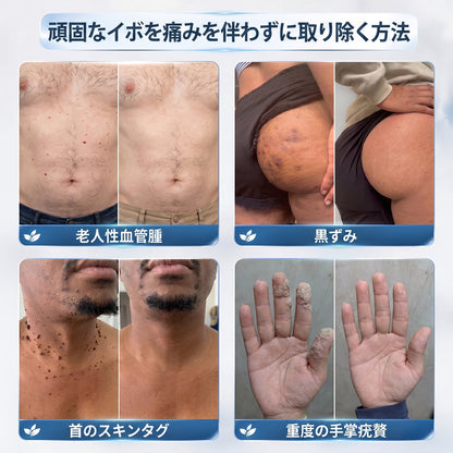 🌿𝐇𝐢𝐒𝐤𝐢𝐧® 🎁 残り2箱のみ！Hiskin® 🎁 ではさらに50%割引！あなたの活力と健康を取り戻すお手伝いをします。
