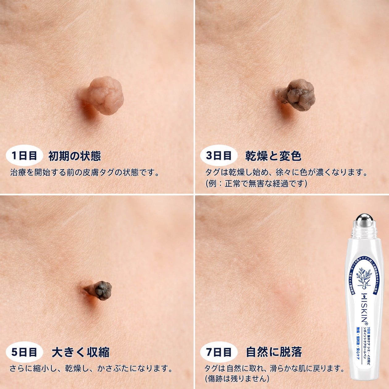 🌿𝐇𝐢𝐒𝐤𝐢𝐧® 🎁 残り2箱のみ！Hiskin® 🎁 ではさらに50%割引！あなたの活力と健康を取り戻すお手伝いをします。