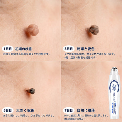 🌿𝐇𝐢𝐒𝐤𝐢𝐧® 🎁 残り2箱のみ！Hiskin® 🎁 ではさらに50%割引！あなたの活力と健康を取り戻すお手伝いをします。